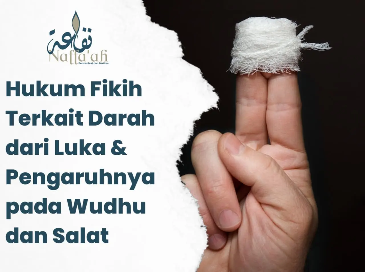 Hukum Fikih Terkait Darah dari Luka & Pengaruhnya pada Wudhu dan Salat